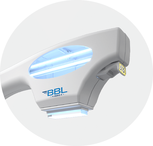 BBL HERO BroadBand Light Therapy