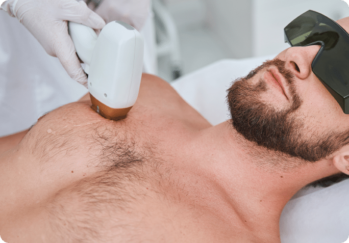 Laser Hair Removal