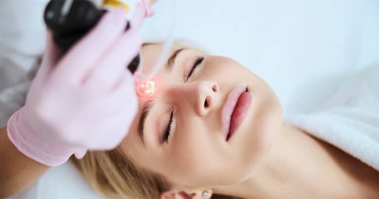 top laser skin resurfacing treatment for you